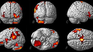 Captan por 1ª vez la reacción cerebral a una experiencia extracorporal